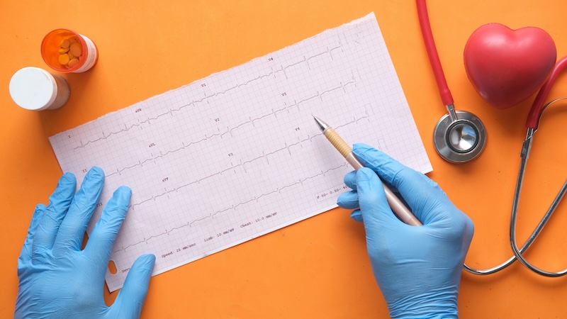 Enfermedades Cardiacas EEUU