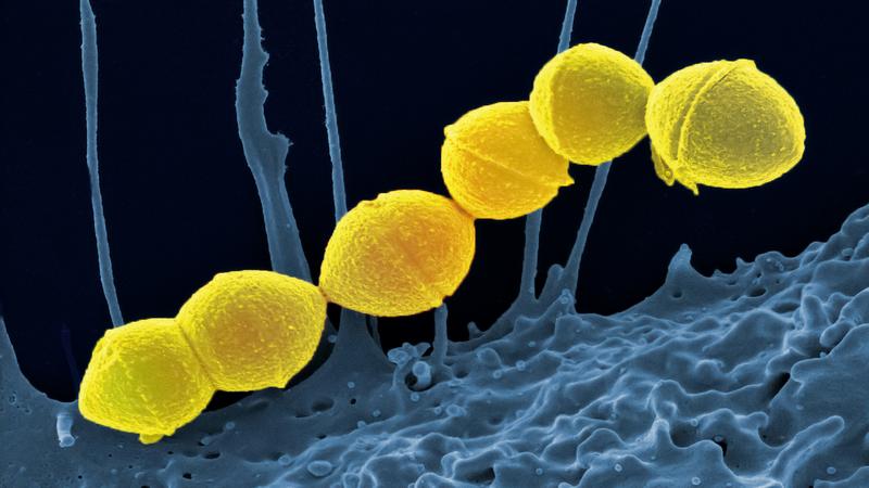 helicobacter pylori engorda o adelgaza